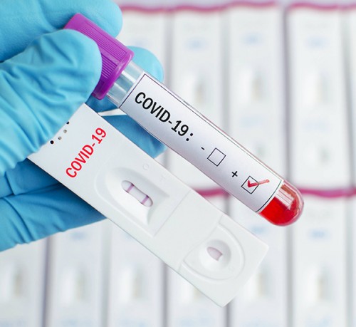 Пробовзимания за тестове за COVID-19
