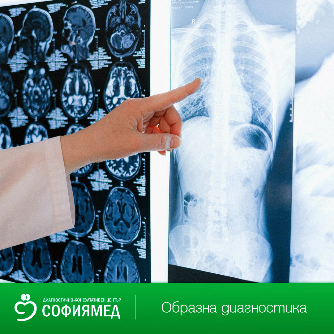 Специални празнични часови графици за провеждане на скенер и рентген на бял дроб в ДКЦ „Софиямед“ БЛОК 1