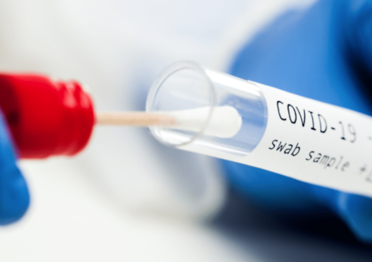 Празнично работно време на пунктове за пробовземане на тестове за COVID-19 и ваксинационни кабинети