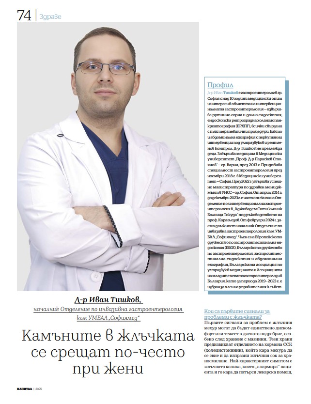 Д-р Иван Тишков: Камъните в жлъчката се срещат по-често при жени 
