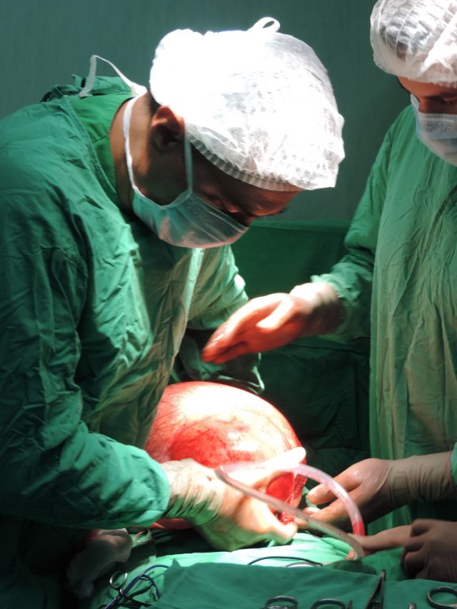 Киста с размер по-голям от футболна топка отстраниха хирурзите в „Софиямед“