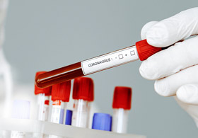 ДКЦ „Софиямед“ с тестове за количествено и качествено определяне на антитела за COVID-19