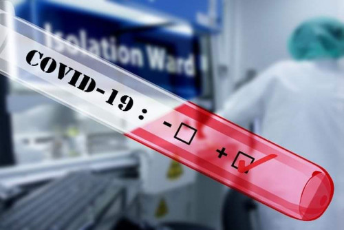 Пробовземане за експресен PCR тест за COVID-19 в празничния 22-ри септември в ДКЦ 