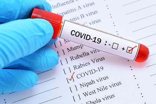 Над 150 позвънявания на ден по въпросите за PCR тестове за коронавирус в „Софиямед“