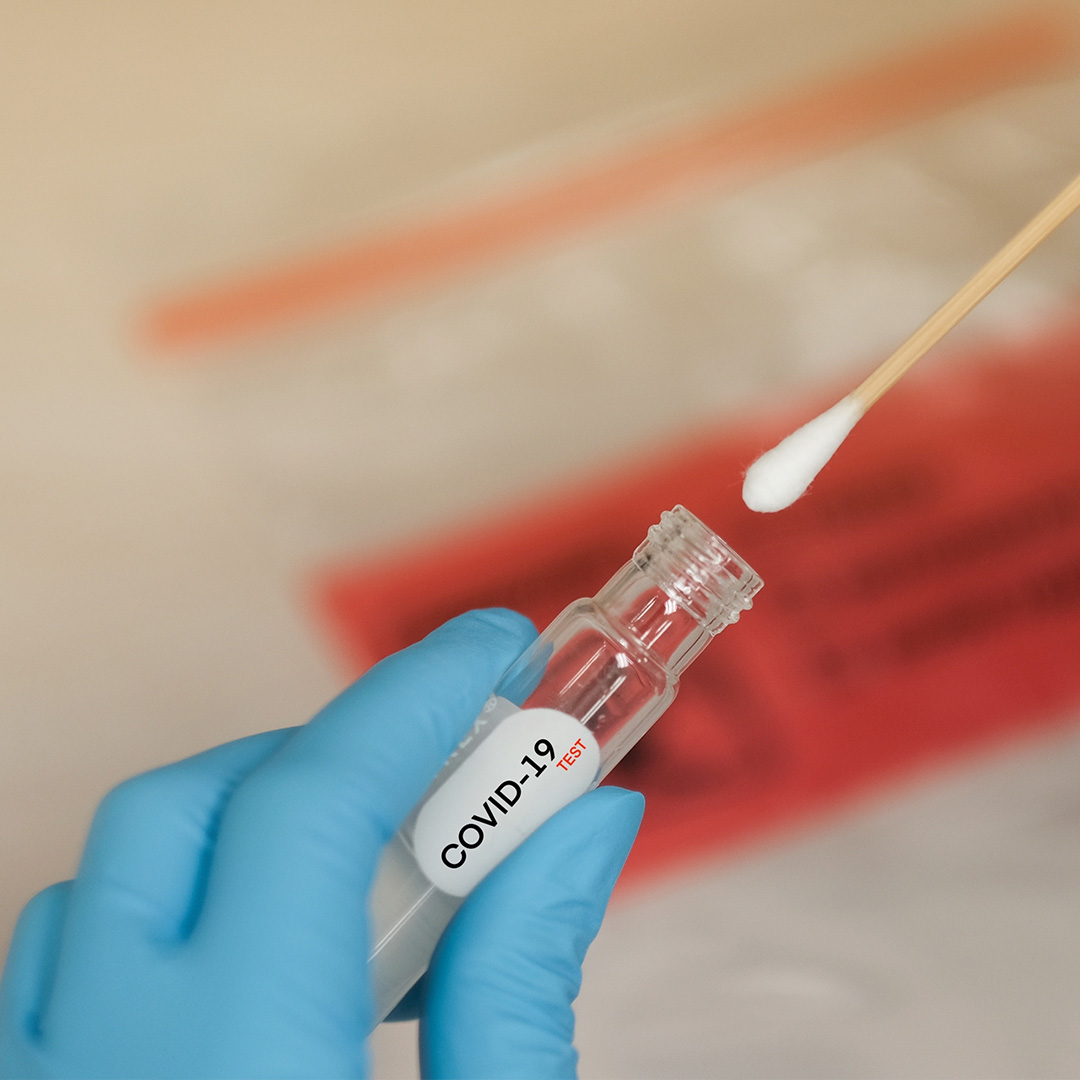 PCR тест за коронавирус